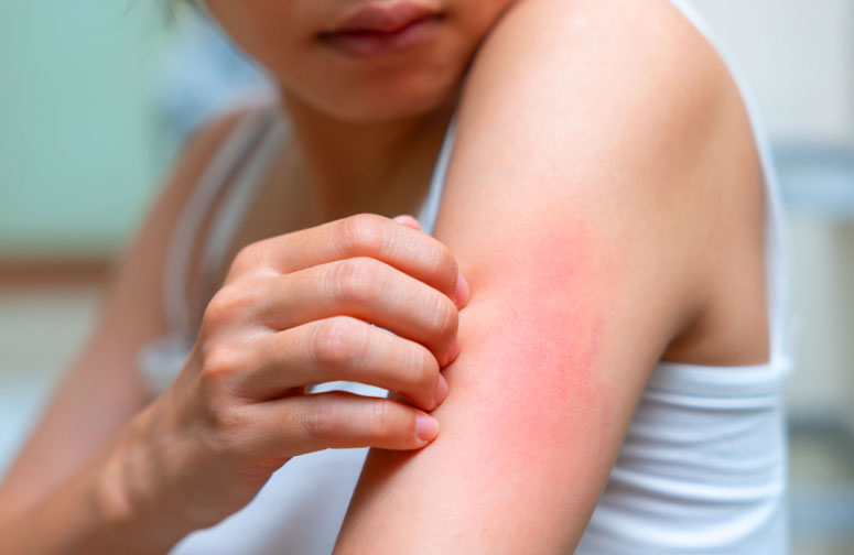 sifilis aumento de sifilis en mexico